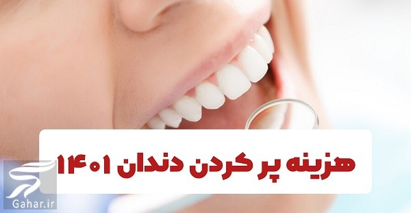 هزینه پر كردن دندان ۱۴۰۱ (جدول کامل هزینه ها)