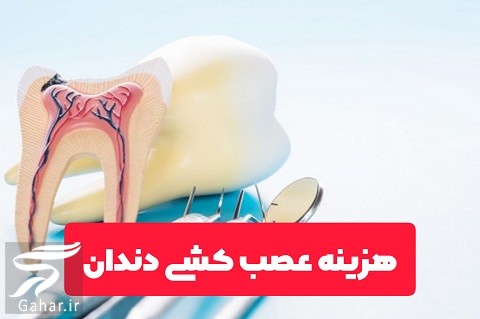هزینه عصب کشی دندان ۱۴۰۱