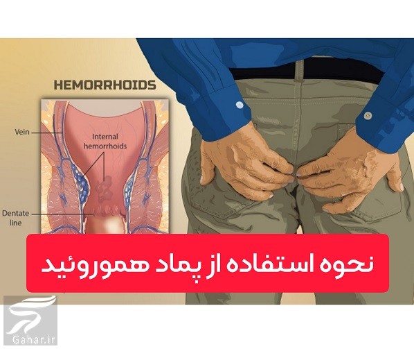 پماد آنتی هموروئید + موارد مصرف و نحوه استفاده