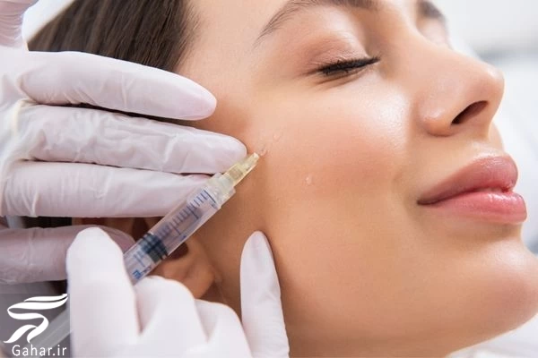 ماندگارترین روش چاقی صورت