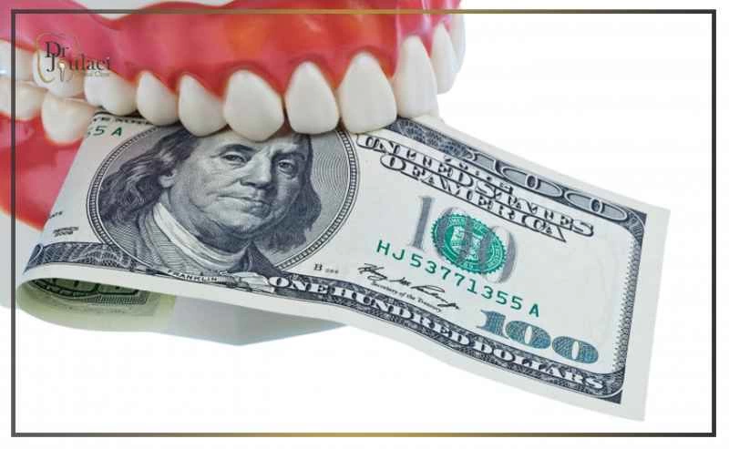 قسطی کردن ایمپلنت ؛ راهحل اقتصادی برای دندانهای ازدسترفته