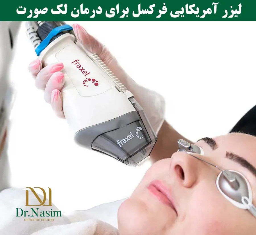لیزر لک صورت بهتر است یا کرم ضد لک؟ نظر پزشکان خارجی چیست؟