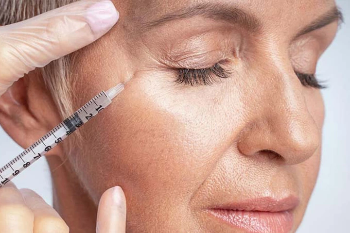چگونه افتادگی گوشه چشم و شقیقه را با روش&zwnj;های نوین برطرف کنیم؟