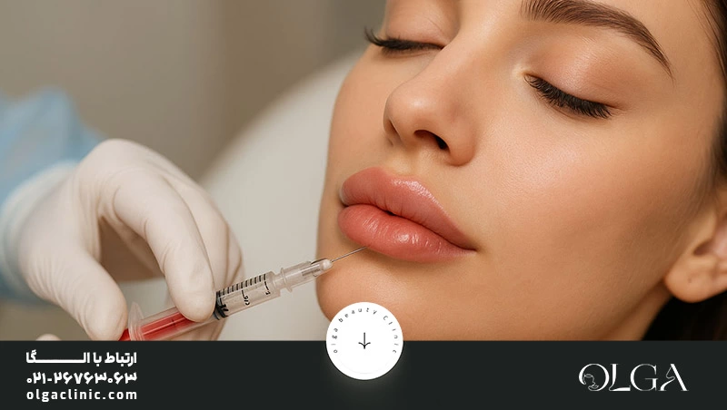 لب روسی چند سی سی ژل لازمه؟